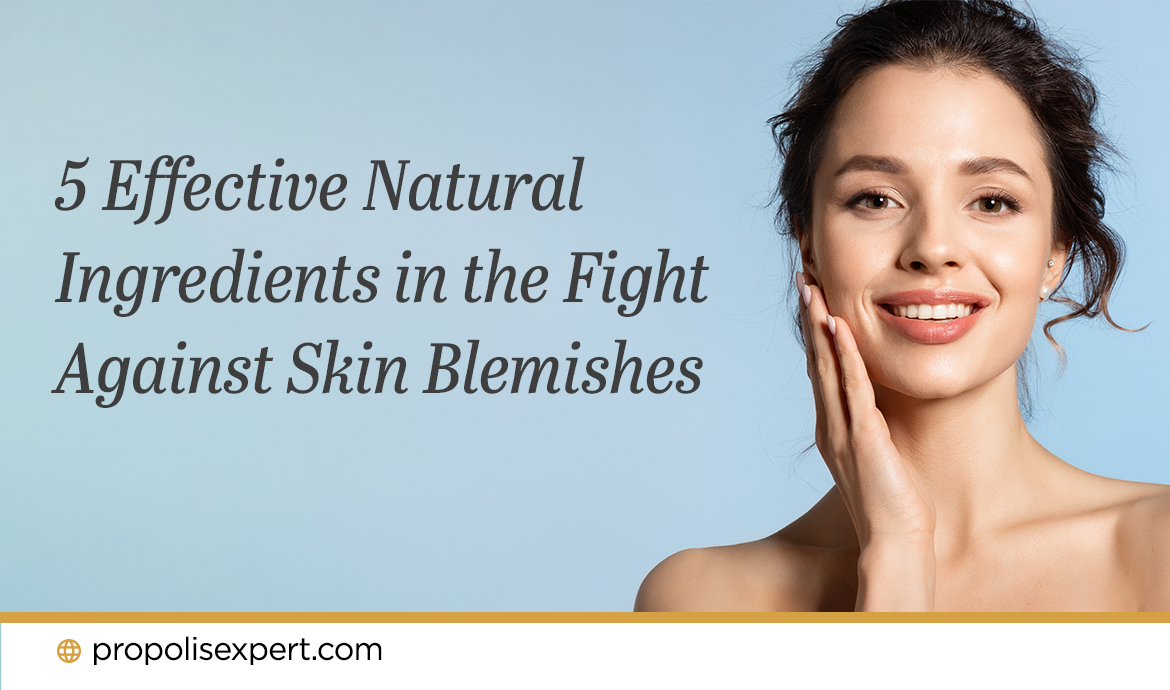 5 Effective Natural Ingredients in the Fight Against Skin Blemishes